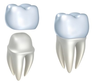 porcelain crowns in our Glasgow office