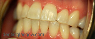 case5-after
