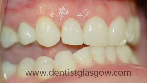 After cosmetic dentistry