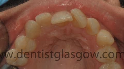 Customsixmonthsmiles2
