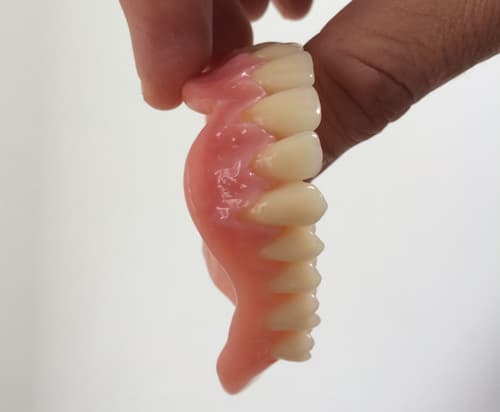 Cosmetic Denture